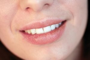 Castlemaine Smiles Dentist | Dental Fluoride Dentist Castlemaine