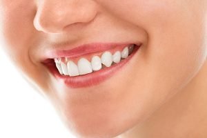 Castlemaine Smiles Dentist | Gum Problem Castlemaine